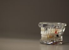 centrul de implantologie