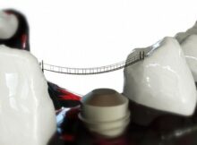 clinica dentara Elveto Dent